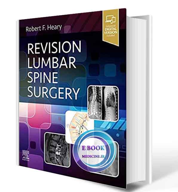 دانلود کتاب Revision Lumbar Spine Surgery 2021 (ORIGINAL PDF)  